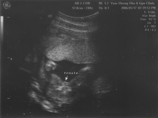 20060517 female